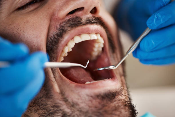 Best Emergency Cosmetic Dentistry (e.g., broken veneers) in Alvarado, TX
