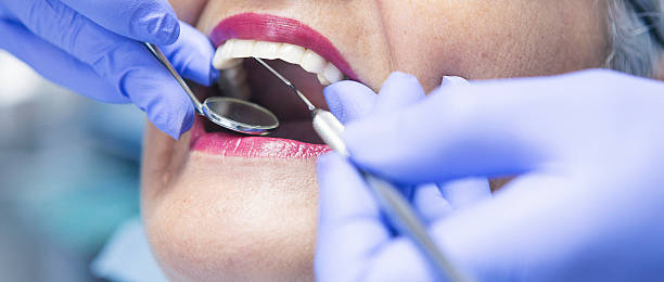 Best Emergency Wisdom Tooth Extraction in Alvarado, TX